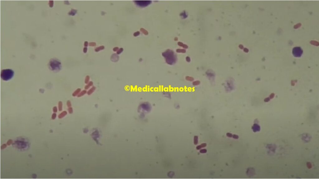 Gram Negative Rods or Bacill of  Raoultella ornithinolytica in Gram Staining of Culture