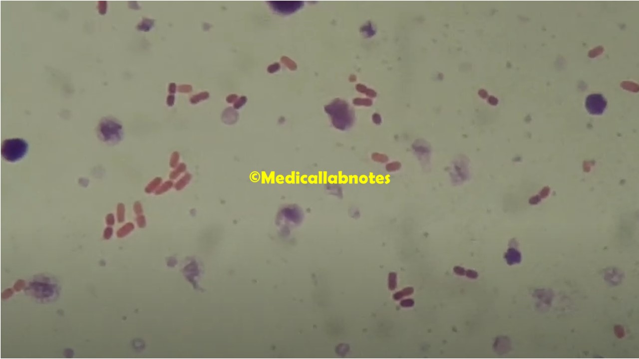 Raoultella Introduction Classification Morphology Pathogenicity Raoultella Introduction Classification Morphology Pathogenicity