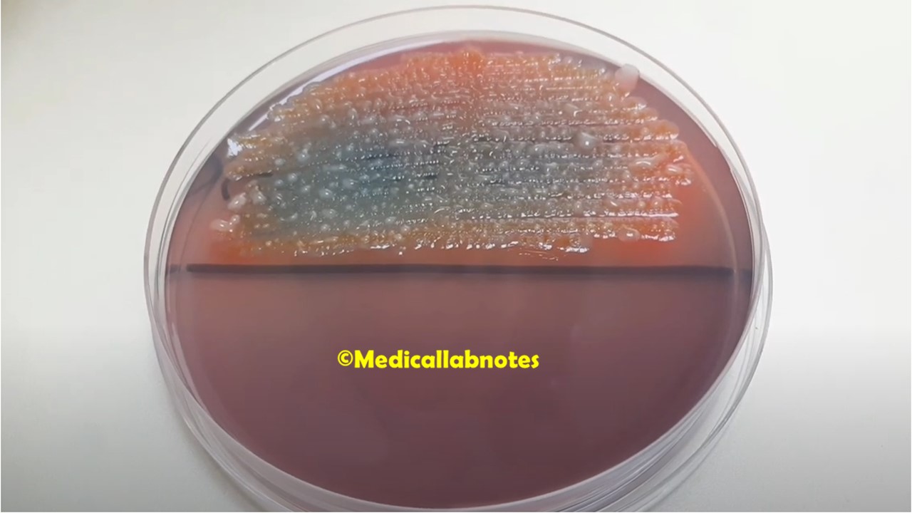 Raoultella ornithinolytica Colony Morphology on CLED agar of Urine Culture