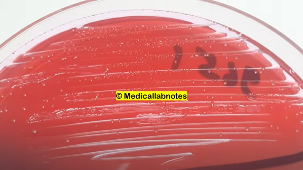 Enterococcus durans Colony Morphology on CLED Agar of Urine Culture