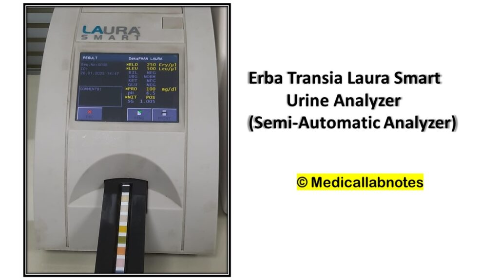 Erba Transia Laura Smart Urine Analyzer (Semi-Automatic Analyzer)