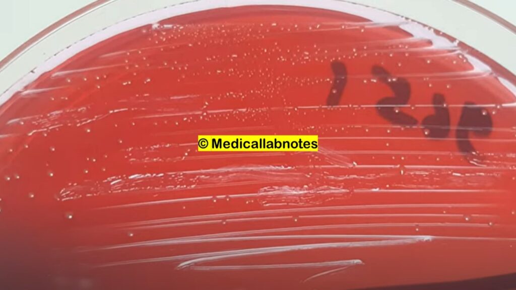 Enterococcus durans growth on CLED agar of Urine Culture