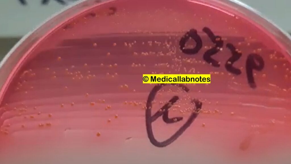 Enterococcus faecium colony characteristics on CLED agar of Urine Culture
