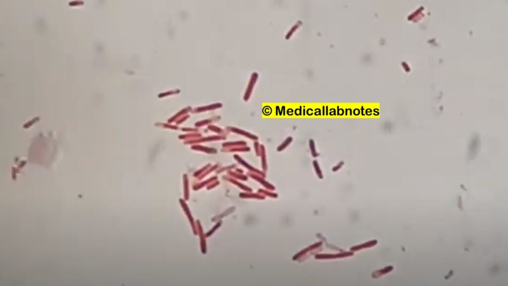 Gram Negative Rods of Citrobacter freundii