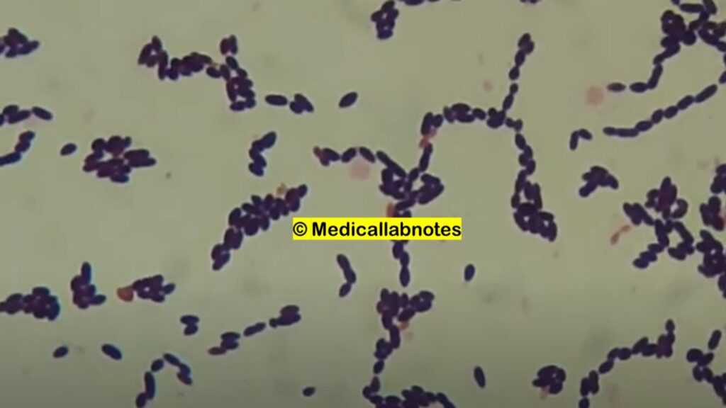 Gram Positive cocci in singles, pairs and chains of Enterococcus faecium at a magnification of 4000X