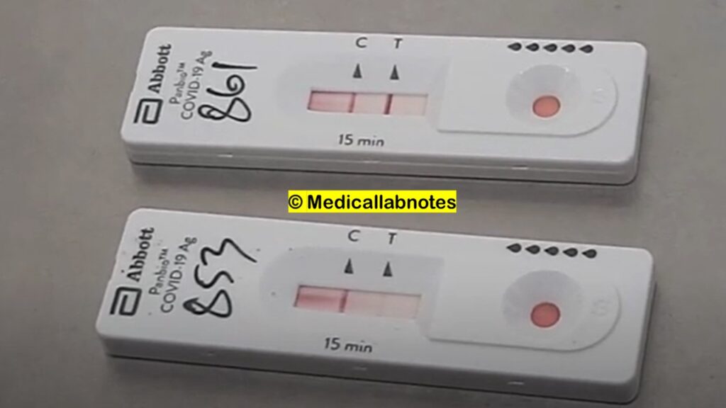 SARS-COV-2 Antigen Test Strong Positive-Upper while weak positive -lower test device