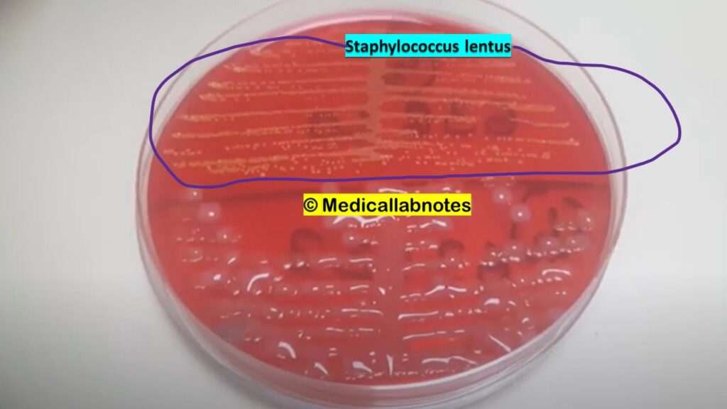 Staphylococcus lentus colony characteristics on CLED agar of urine culture_