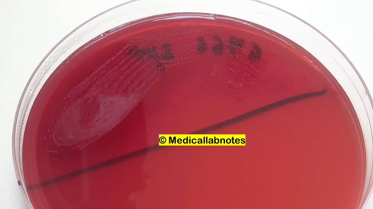 Streptococcus oralis colony morphology on MacConkey agar