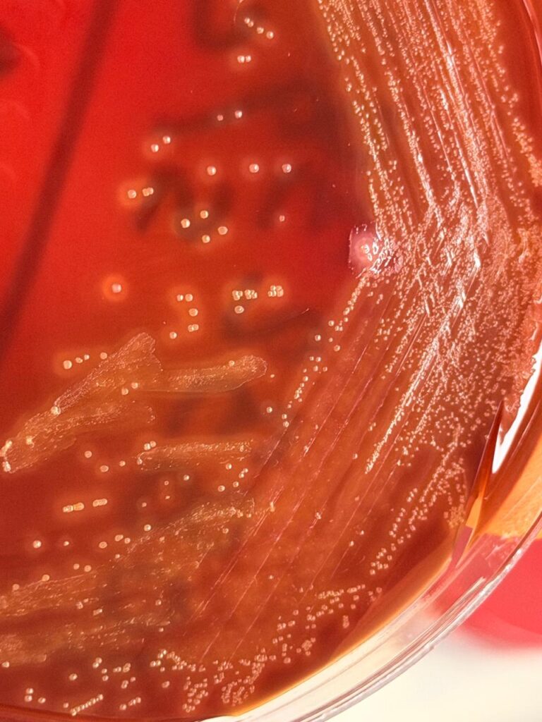 Streptococcus oralis colony morpphology on blood agar
