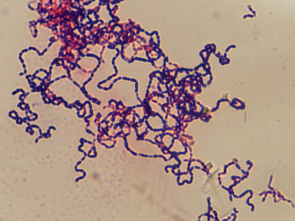Streptococcus oralis in Gram staining of culture at a magnification of 1000x with 4x optical zoom