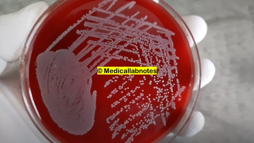 Another organism responsible for quorum sensing- Staphylococcus aureus and its growth on blood agar of clinical specimen, pus