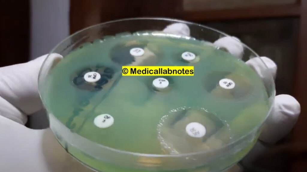Antimicrobial susceptibility testing (AST) pattern of Pseudomonas aeruginosa on Muller-Hinton agar (MHA)