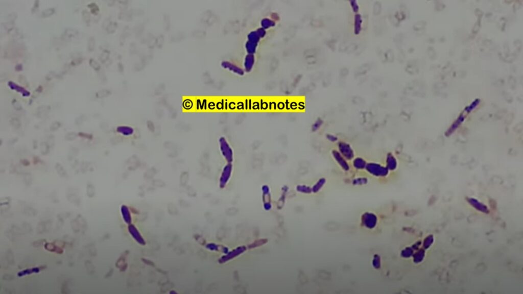 Bacillus species in Gram staining of culture microscopy