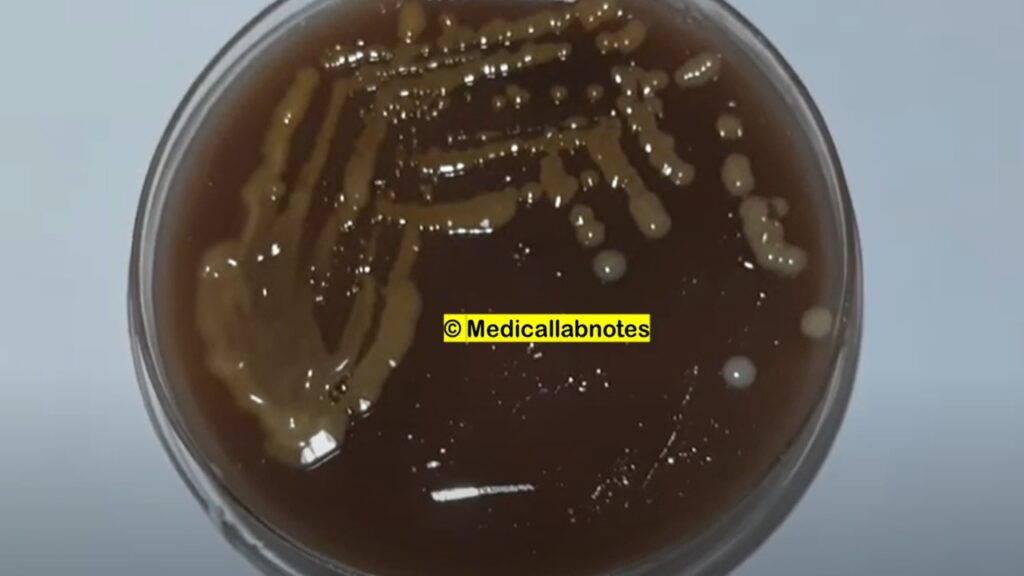 Brownish-yellow pigment of Cryptococcus neoformans on Birdseed agar (BSA)
