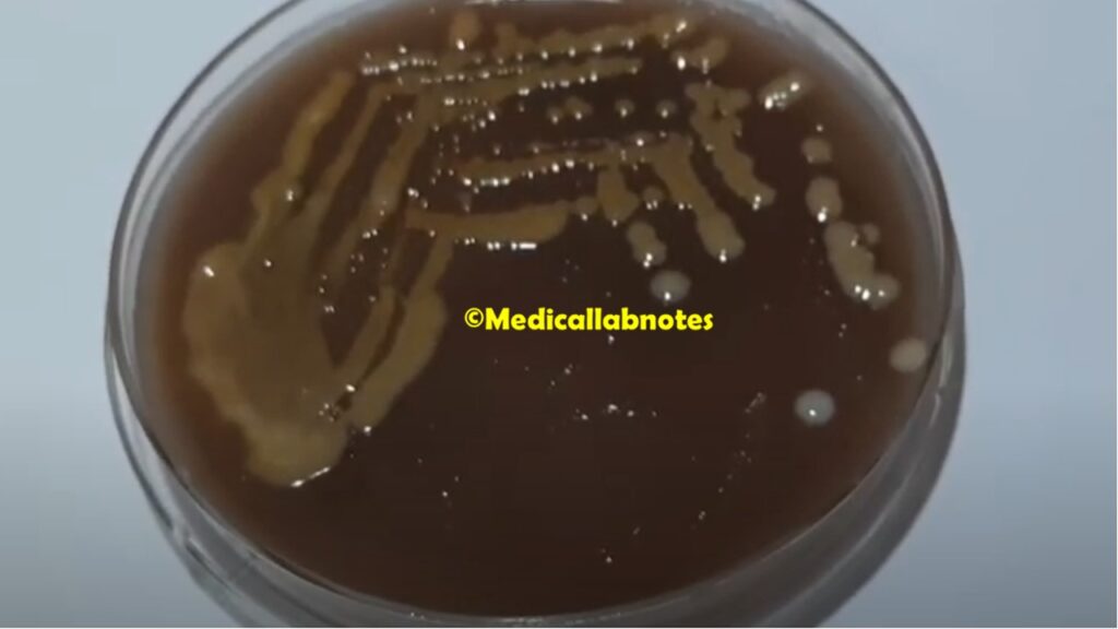 Brownish yellow-pigmented smooth colonies of Cryptococcus neoformans on bird seed agar (BSA)