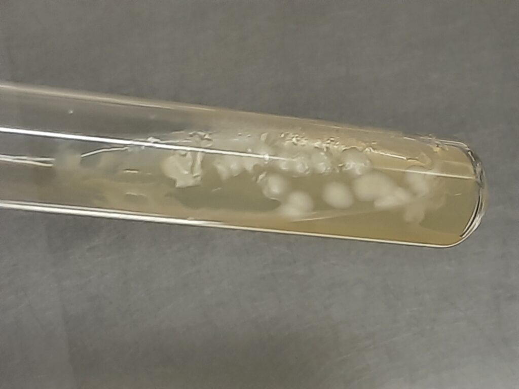 Candida tropicalis colony morphology on Sabouraud dextrose agar