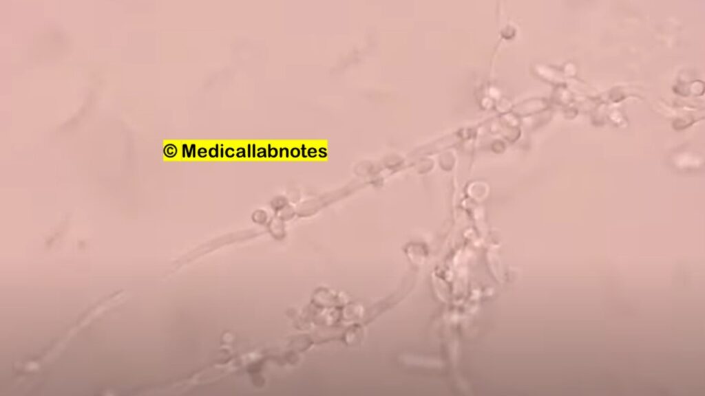 Chlamydospores of Candida albicans