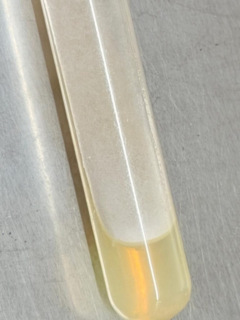 Colony morphology of Penicillium on Sabouraud Dextrose Agar (SDA)