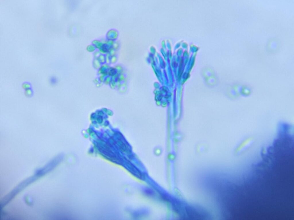 Condia, Conidiophores,Phialides,metulae, hyphae of Penicillium