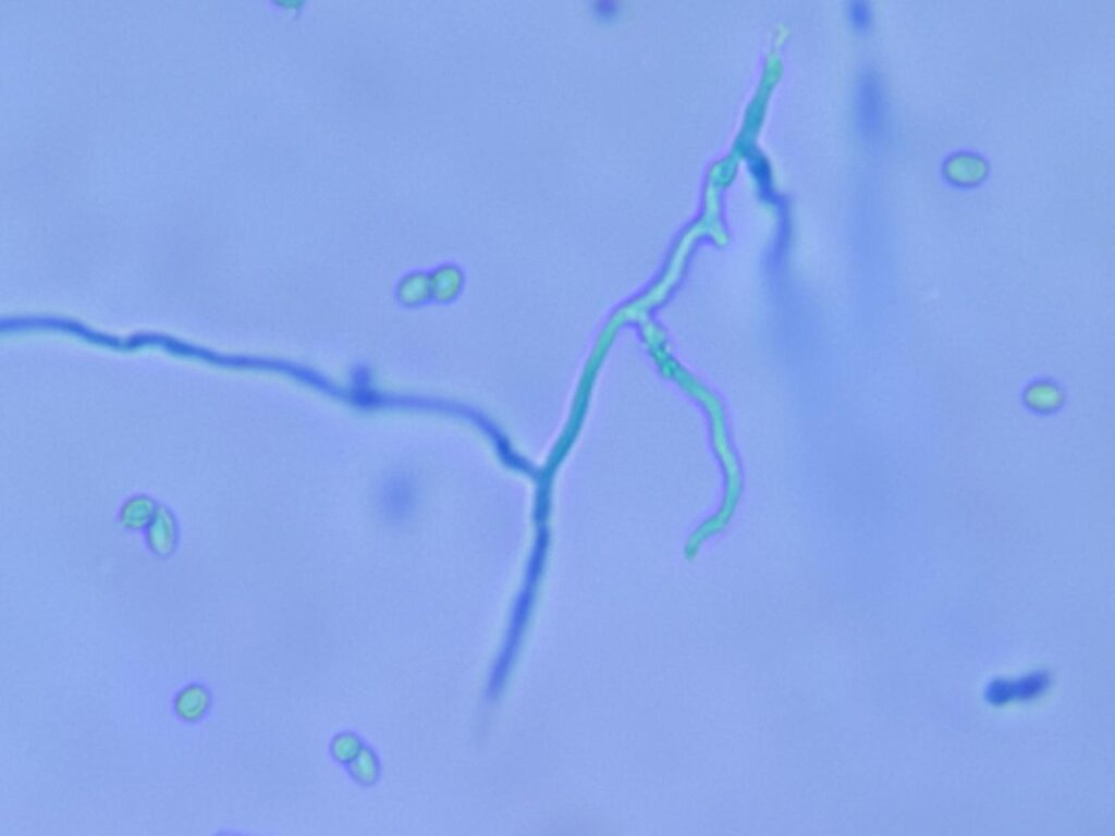 Condia, and branched hyphae of Penicillium