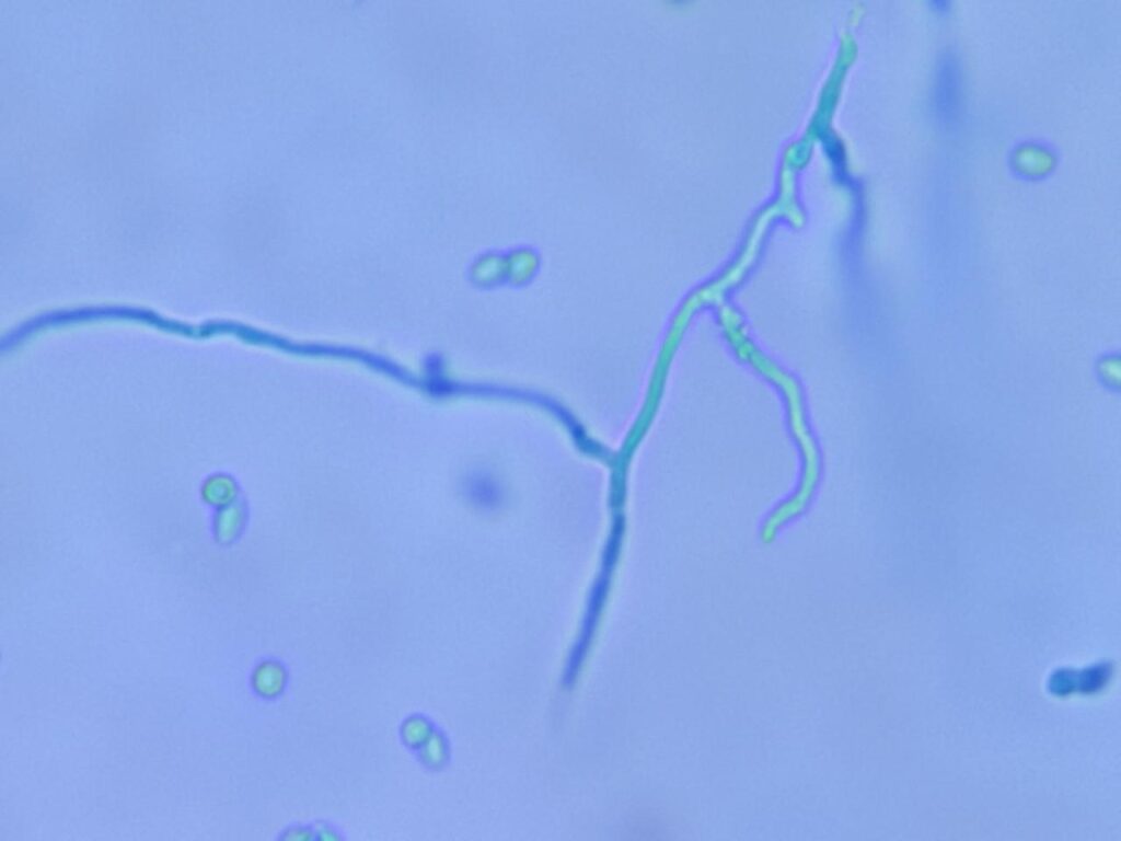 Condia, and hyphae of Penicillium