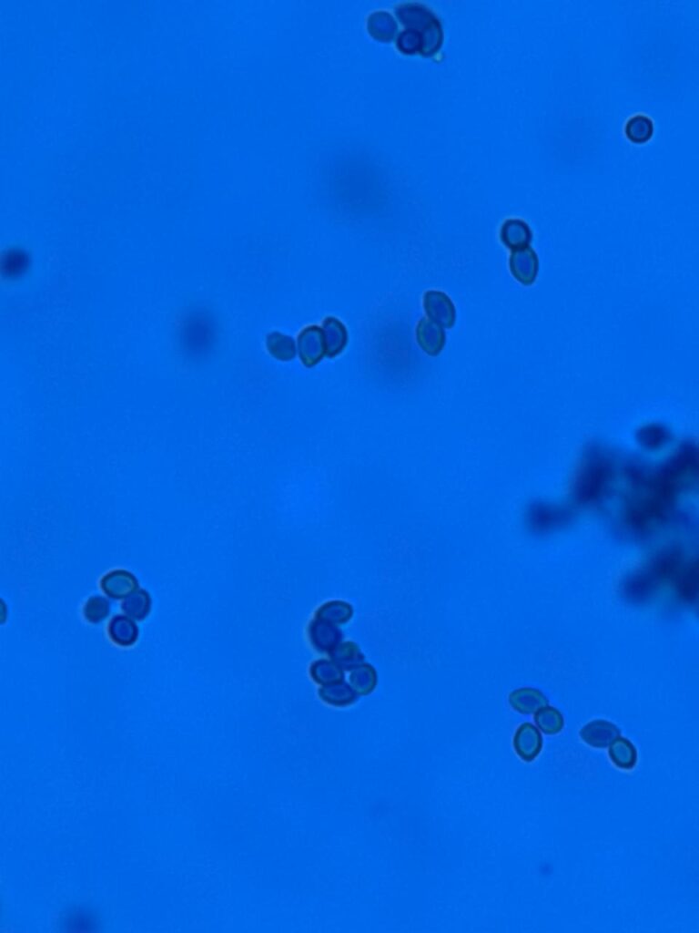 Conidia of Penicillium in LPCB tease of culture at a magnification of 400x with 8x optical zoom