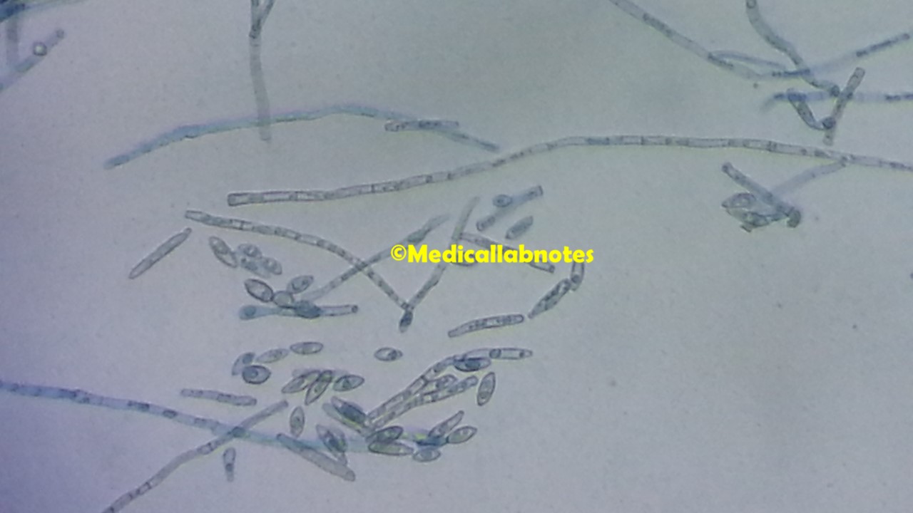 Conidiophores and conidia of Ochroconis gallopava in LPCB tease mount of culture microscopy