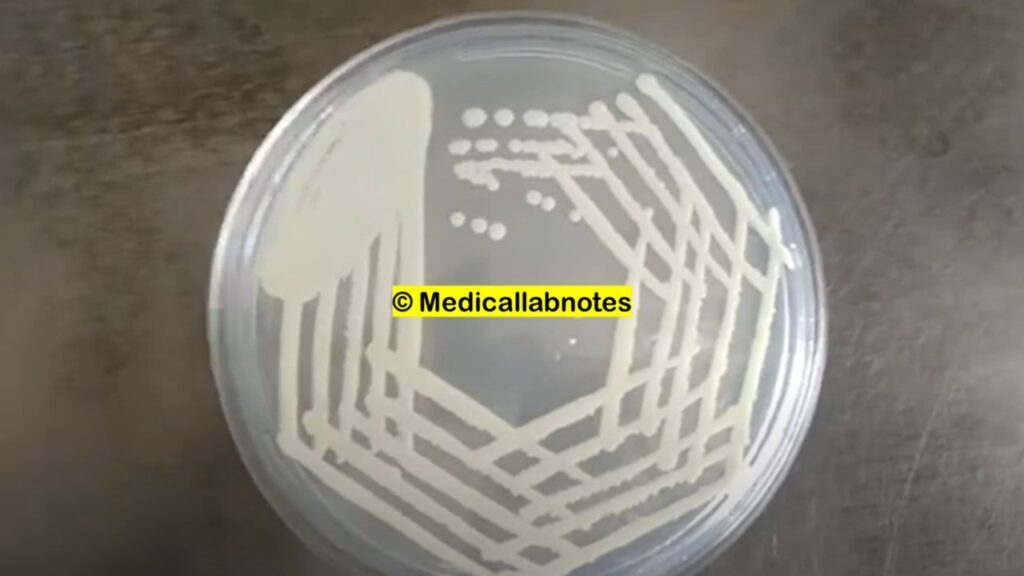 
Cream-coloredpasty and glistening colonies of Candida albicans on Sabouraud-Dextroseagar (SDA) plate