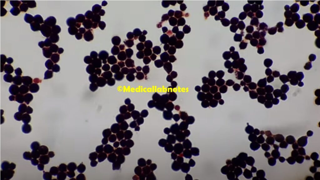 Cryptococcus neoformans in Gram staining of culture showing Gram positive yeast cells