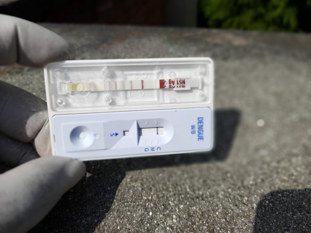 Dengue Virus NS1 Antigen and IgM and IgG Test