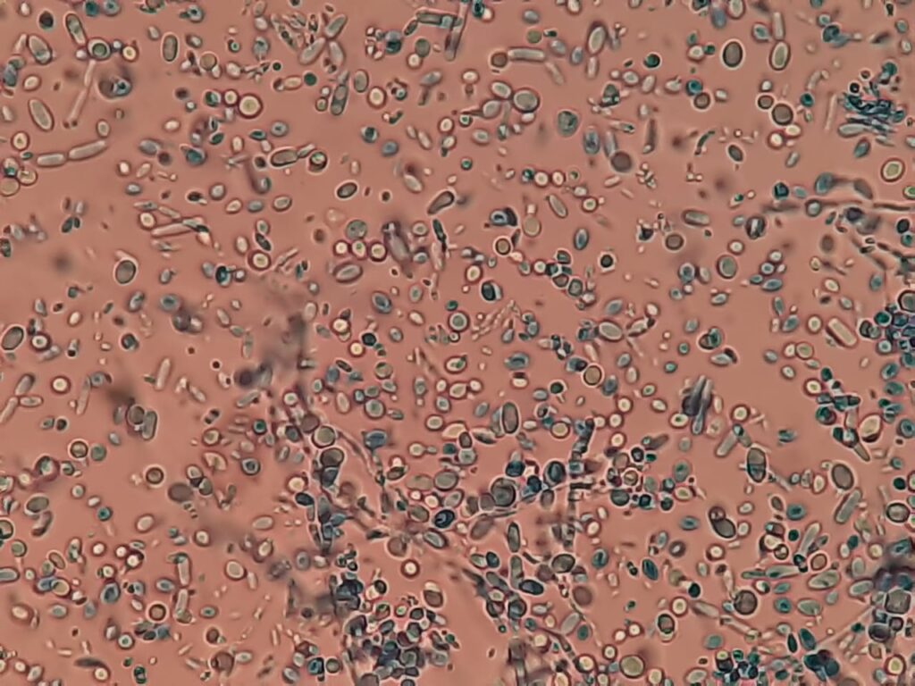 Globose, oblong-ellipsoidal to cylindrical yeast cells of Malassezia in LPCB preparation of culture microscopic examination