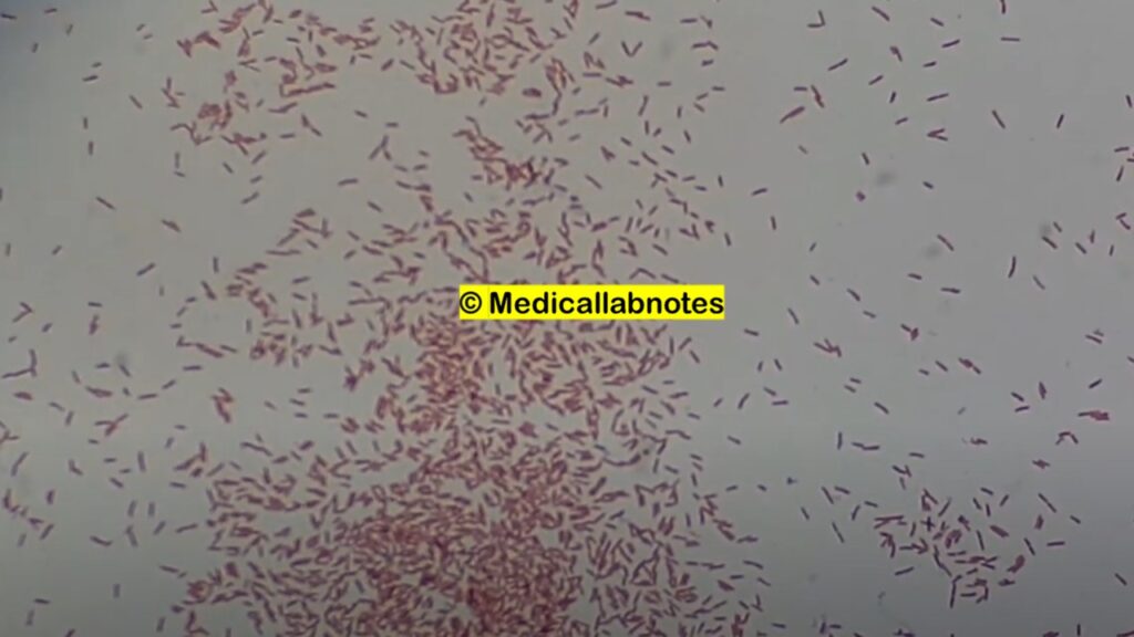 Gram negative rofds of Pseudomonas aeruginosa  in Gram staining of culture microscopy