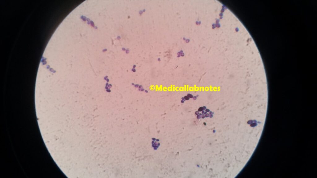 Gram positive Yeast cells of Candida krusei in Gram staining