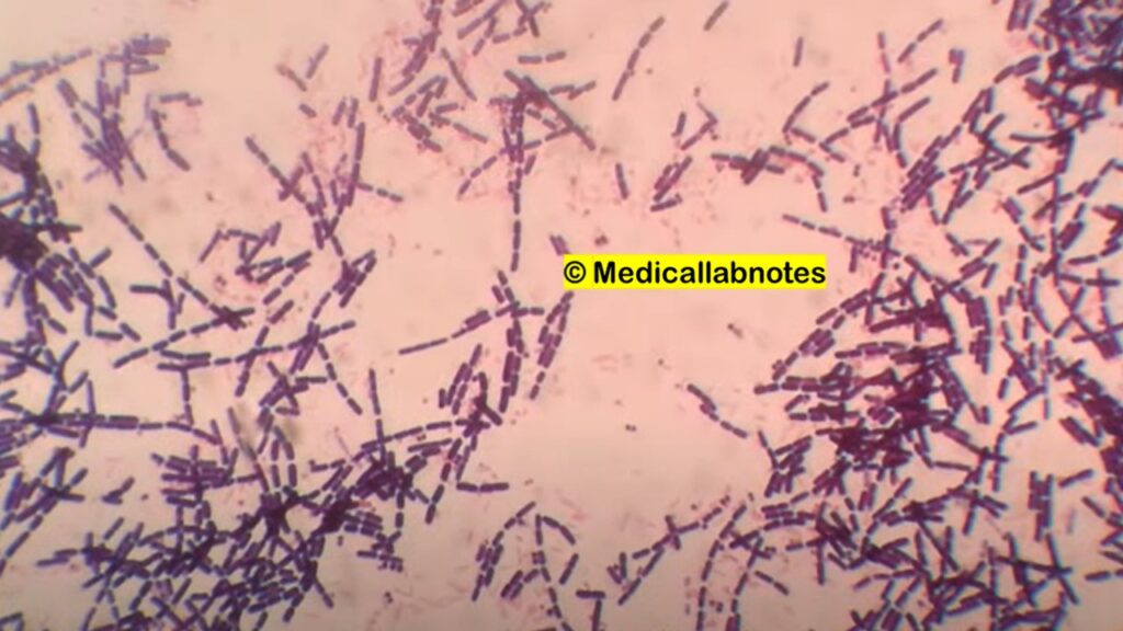 Gram positive rods or Gram positive bacilli of Bacillus species in Gram staining of culture microscopy