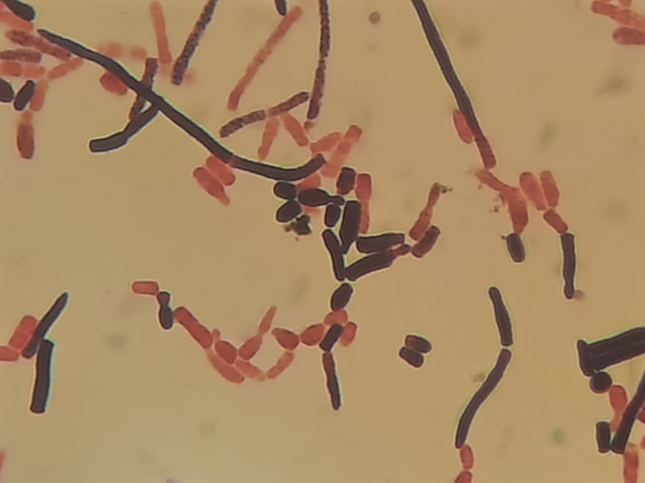Gram-positive to variable yeast cells and short hyphae of Malassezia in Gram staining of culture