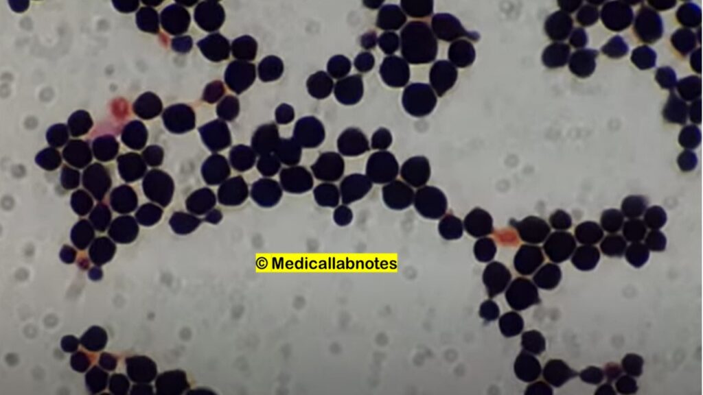 Gram positive yeasts of Cryptococcus in Gram staining of culture microscopy at a magnification of 4000X