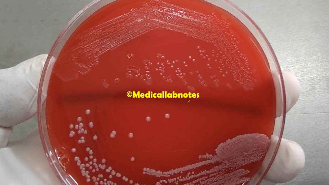 Listeria monocytogenes colony morphology on blood agar-Upper side