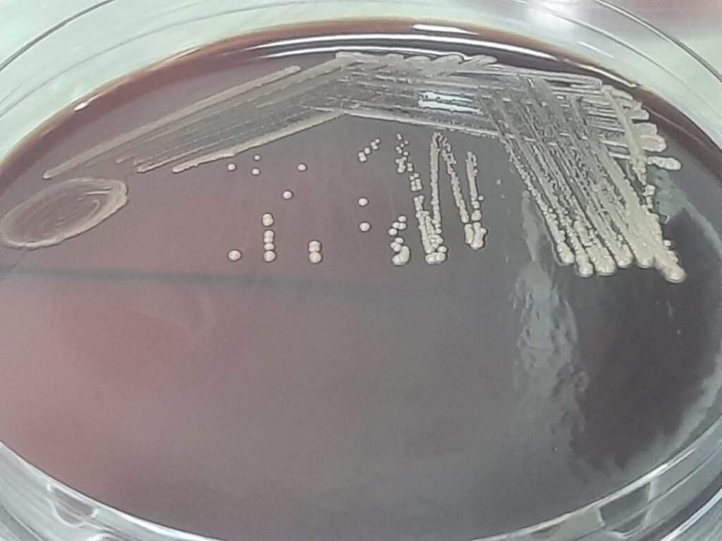 Malassezia growth on Blood agar