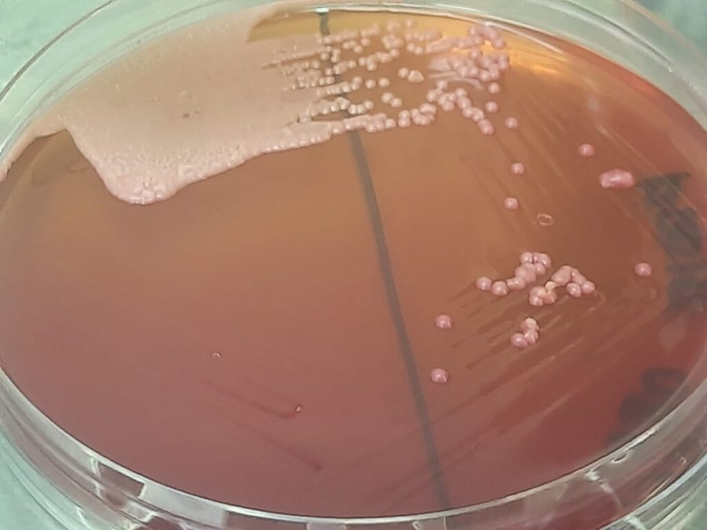 Malassezia growth on MacConkey agar without bile salt