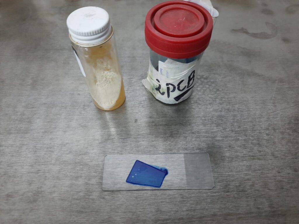 Malassezia growth on Sabouraud dextrose agar (SDA)