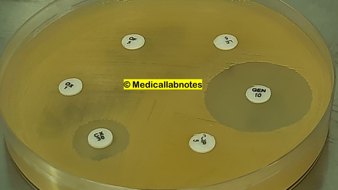 Nasal Methicillin-resistant Staphylococcus aureus (MRSA) Carriage expressing Cefoxitin and Oxacillin Resistance on Muller-Hinton agar (MHA)