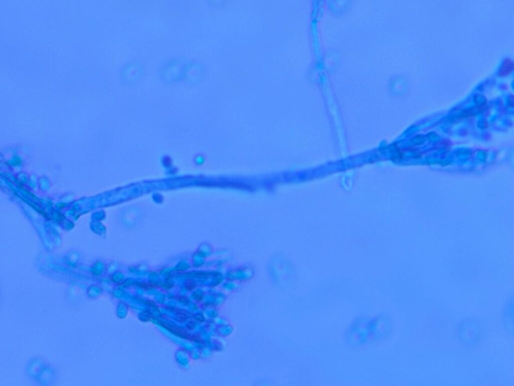 Penicillium in LPCB tease mount of culture