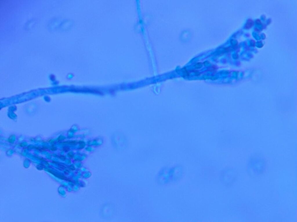 Penicillium in LPCB tease mount of culture showing Condia, Conidiophores,Phialides,metulae, and hyphae