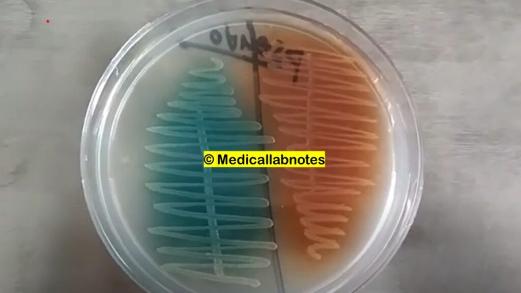 Pseudomonas aeruginosa growth on Nutrient agar and  and applicable for Quorum sensing