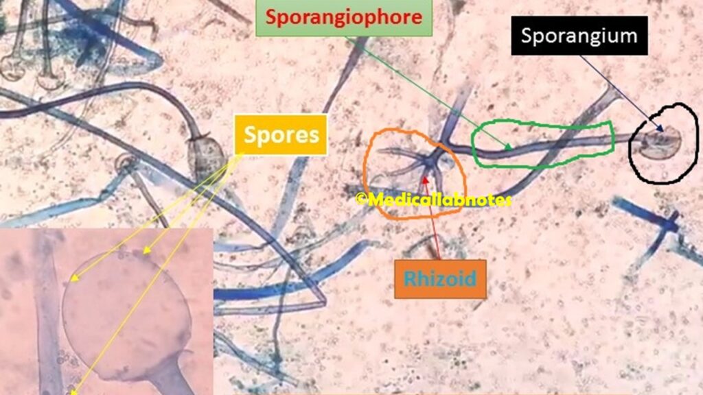 Spores, sporangiophore, sporangium and rhizoid of Rhizopus demonstration