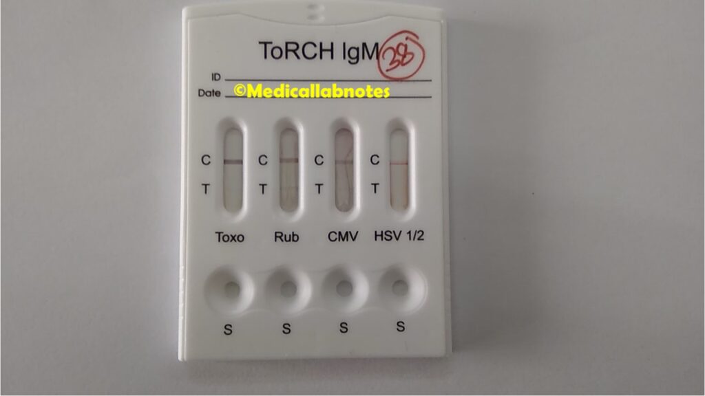 TORCH Panel Test device showing Rubella IgM -Positive