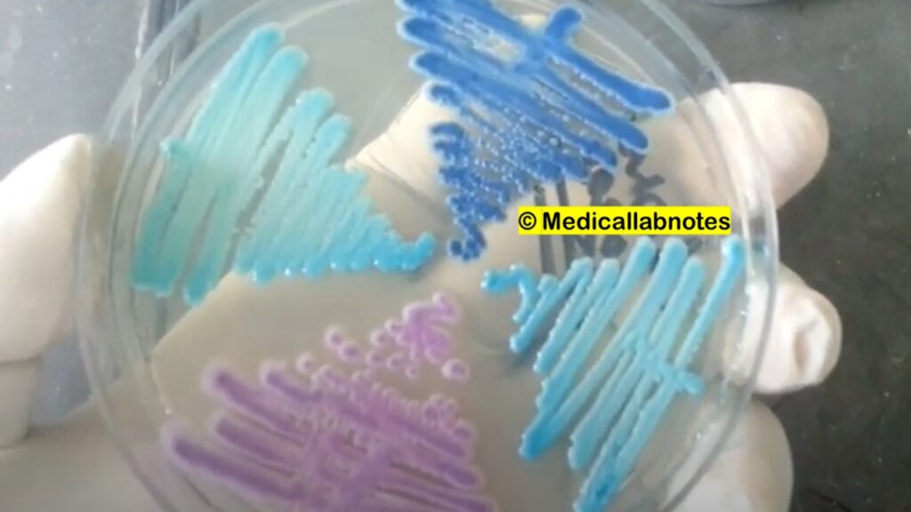 Various Candida species growth on Candida CHROMagar-Candida abicans-green, Candida glabrata-Cream to white, Candida krusei-Purple to fuzzy, and Candida tropicalis-blue to purple 
