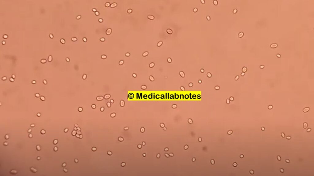 Yeast cells of Candia in wet mount of culture microscopy