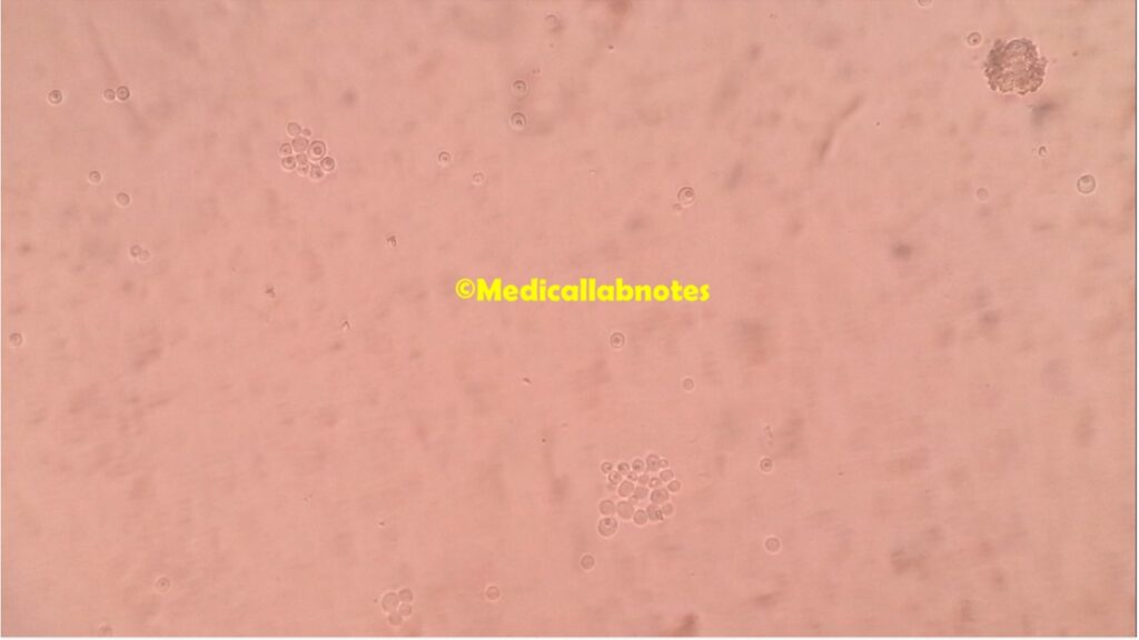 Yeast cells of Candida krusei in saline wet mount of culture microscopy