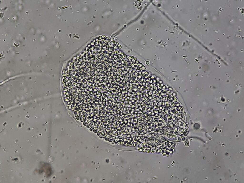 Yeast cells of Candida tropicalis in KOH mount of sputum